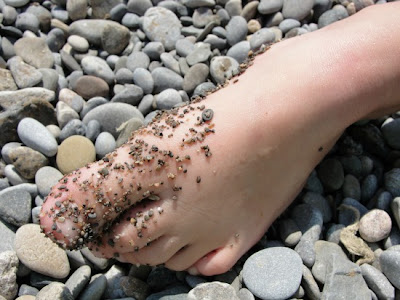 foot covered in rocks